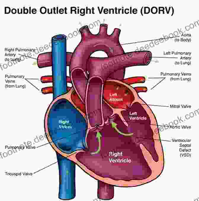 Anatomical Diagram Of Mouse Heart Ventricles, Showing Right Ventricle And Left Ventricle Mouse Heart Fleur Hitchcock